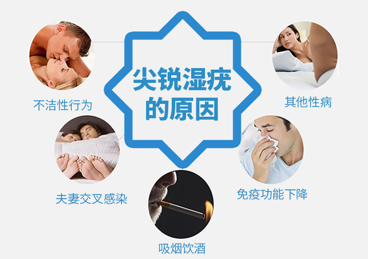 尖锐湿疣的原因