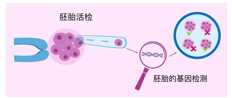 多囊卵巢+弱精症，这对夫妻终于怀上了孩子，秘诀是.....